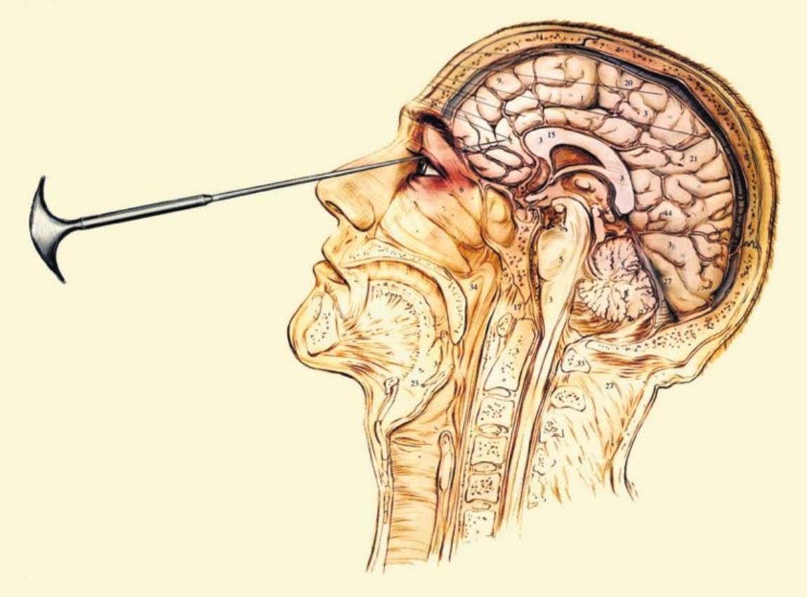 Shell Shock in New Zealand Advances in the History of Psychology