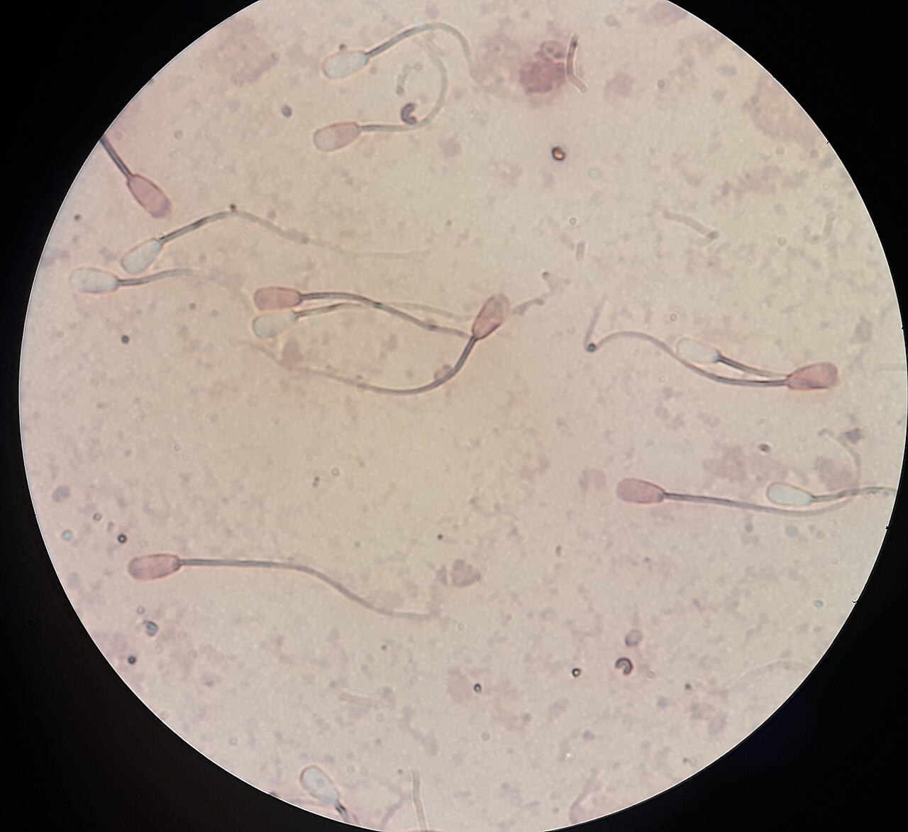 If You Build It, Will They Come? On the Sperm Racing World Cup