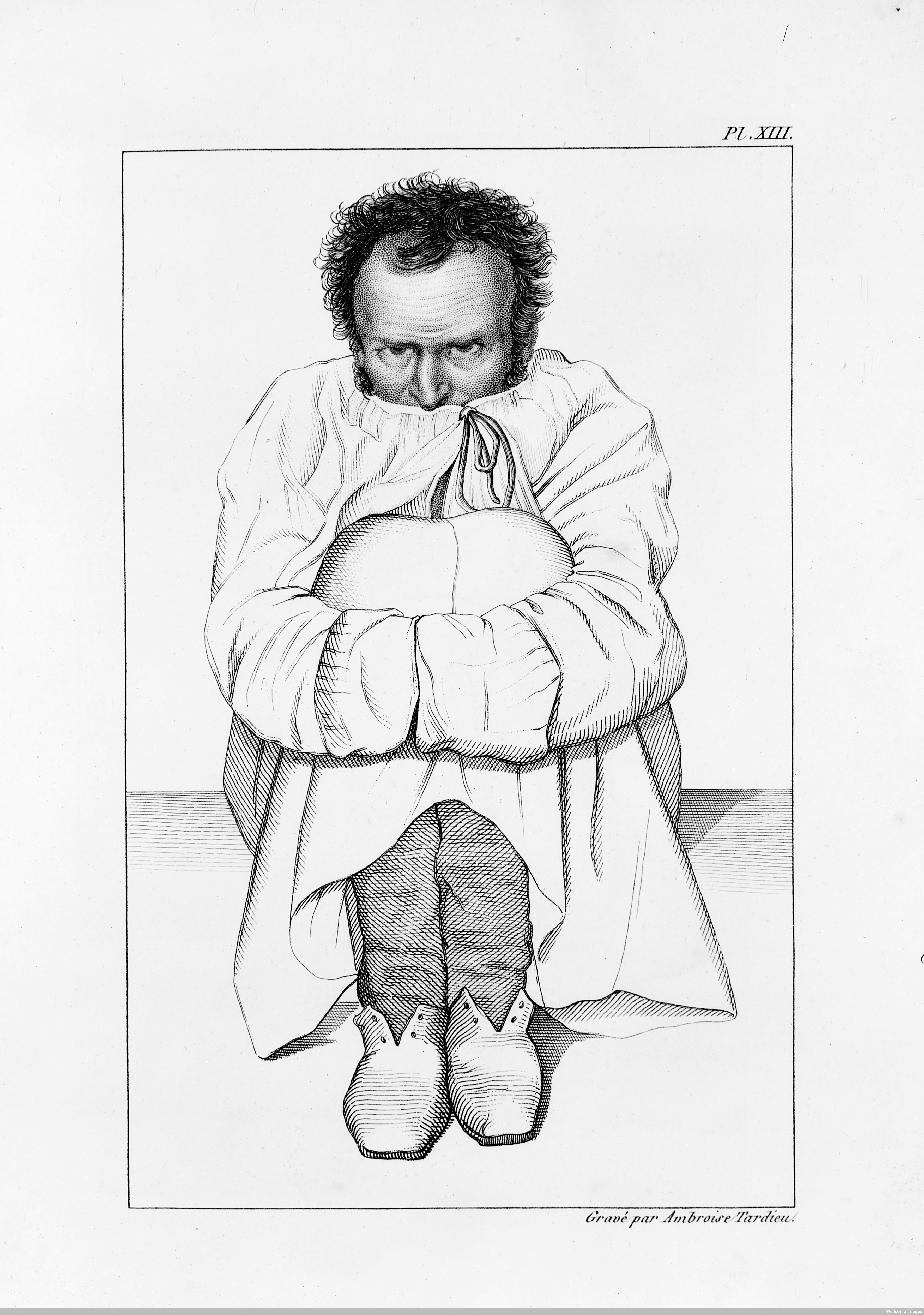L0011307 Maniac in a strait-jacket, in a French asylum.