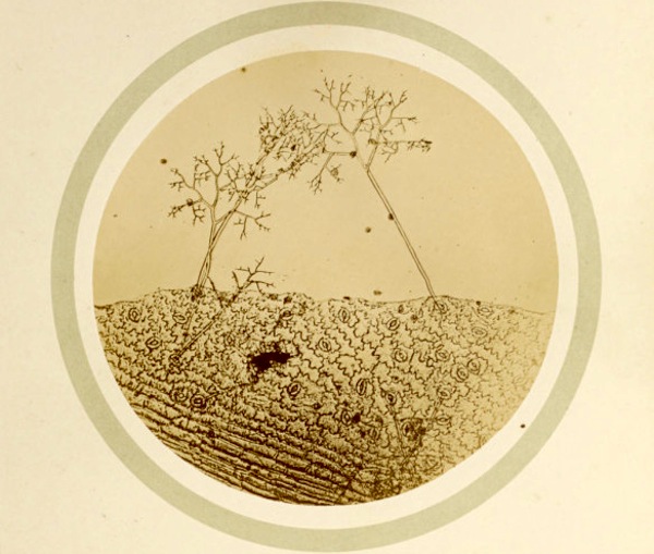 Photography Incubabula: How Early Photographs Got in Books