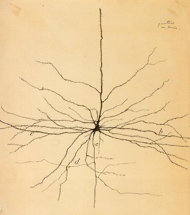 Elon Musk Claims Neuralink Implanted Wireless Brain Chip